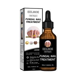 EELHOE Nail Repair Solution, Thickening And Brightening Nails Removing Gray Nail Repair Nourishing Nail Care Solution (Option: 4PCS)